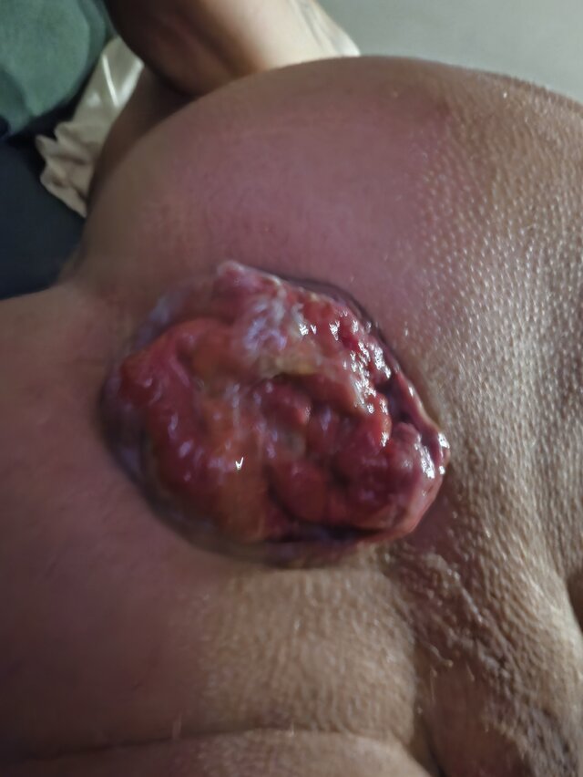 Magic_Holes