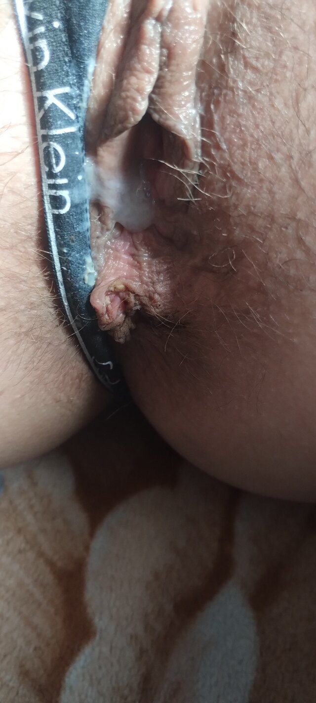 KArMon11
