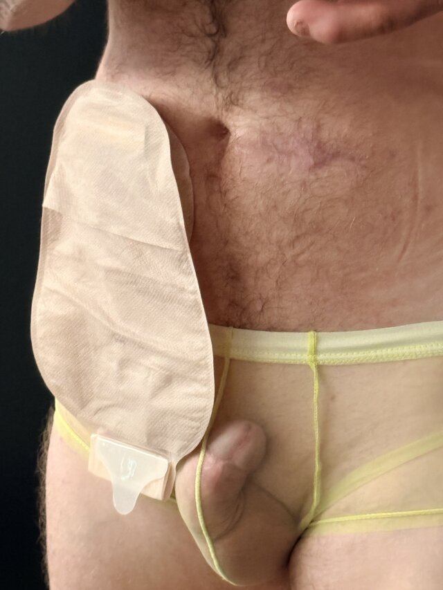 Stomik696941