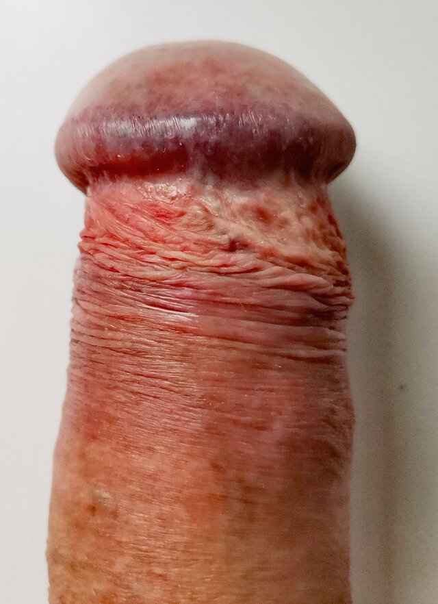 kajtek5