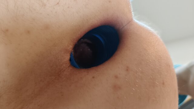 analhole