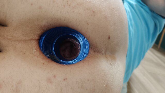 analhole