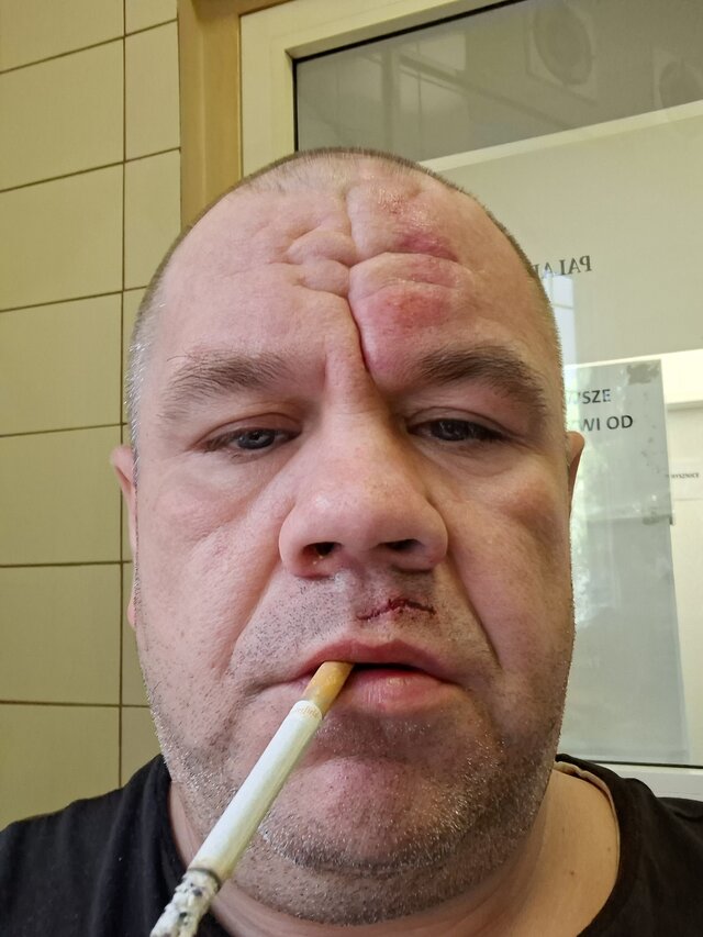 Otis8