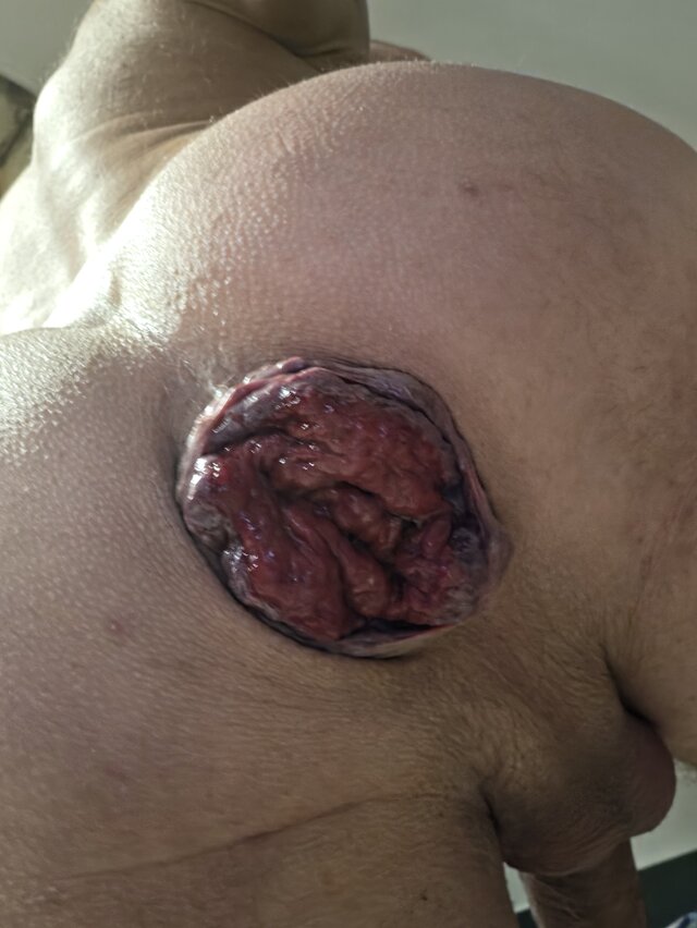 Magic_Holes