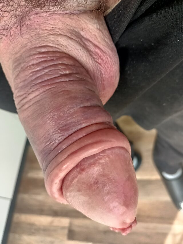 Burura75