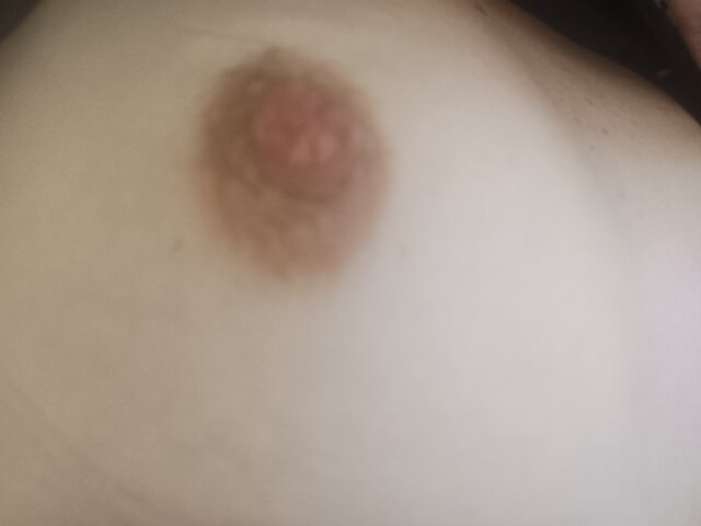NadpalonaParka69
