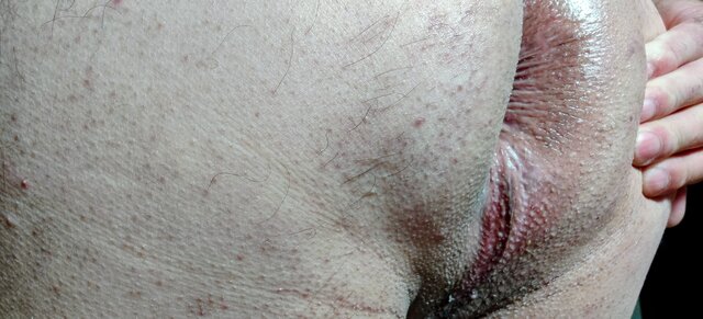 Thomas57
