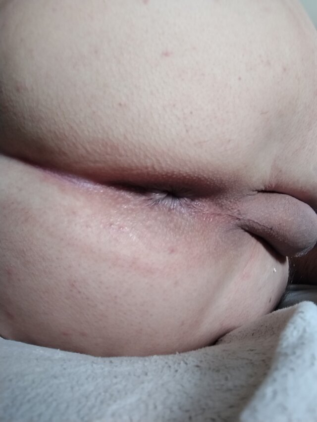 Anallove31