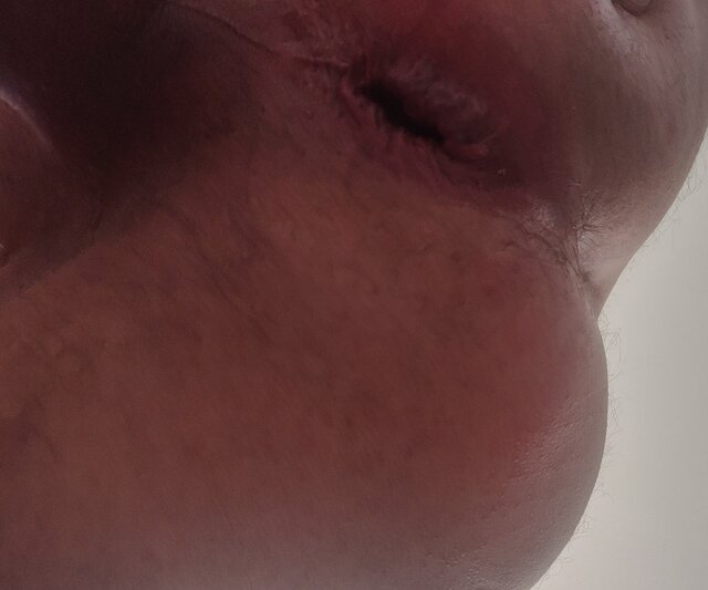 arsen71